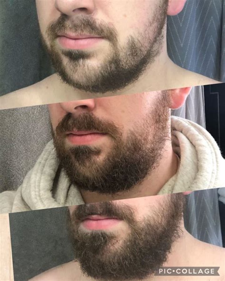 2 Months Of Beard Growth Example 1 Inch YouTube