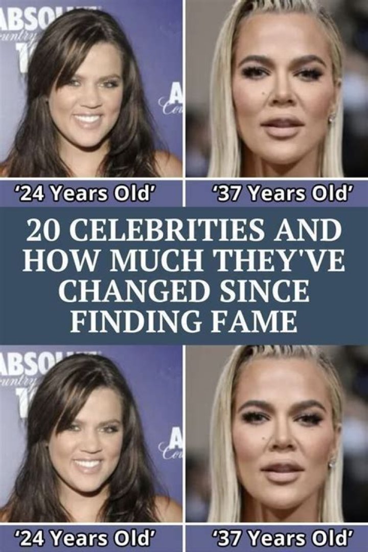20 celebrities and what they would look like without plas...