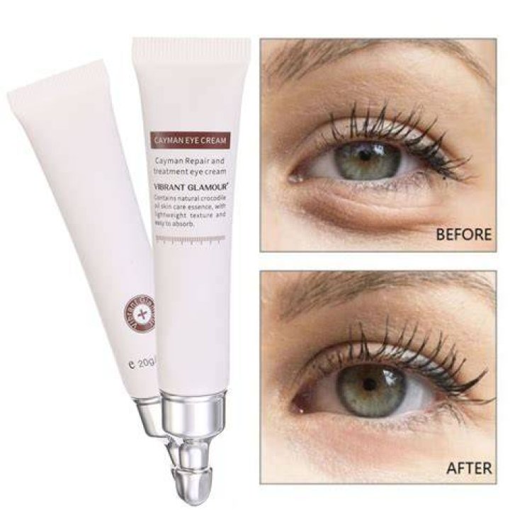20g Best Eye Cream Serum For Dark Circles Puffiness Under Eye Reduce