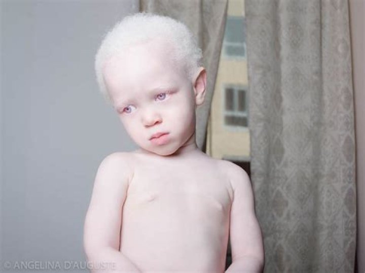 58 Albino People Who&rsquo;ll Mesmerize You With Their Otherworldly Beauty