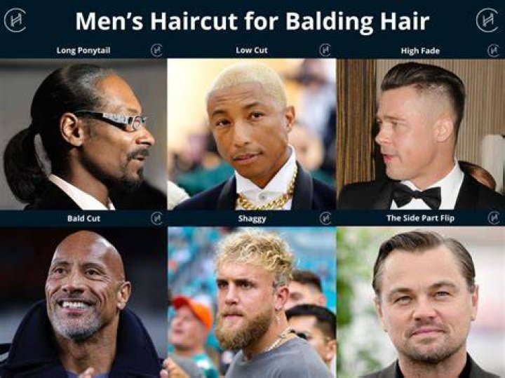 7 Bad Hairstyles Bald Men Need To Avoid Bad haircut, Bad hair, Balding