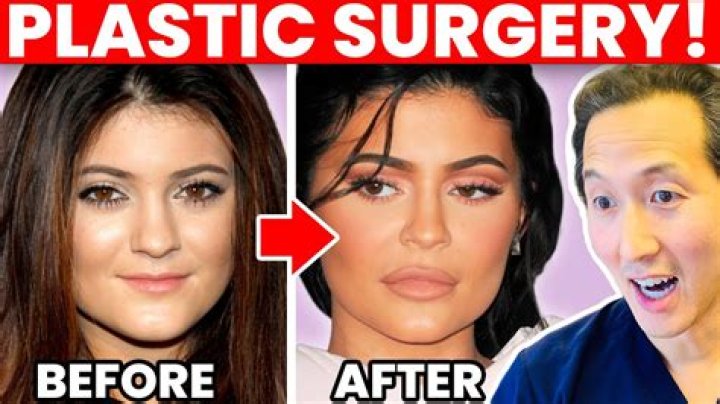 A Journey Of Transformation Before Plastic Surgery