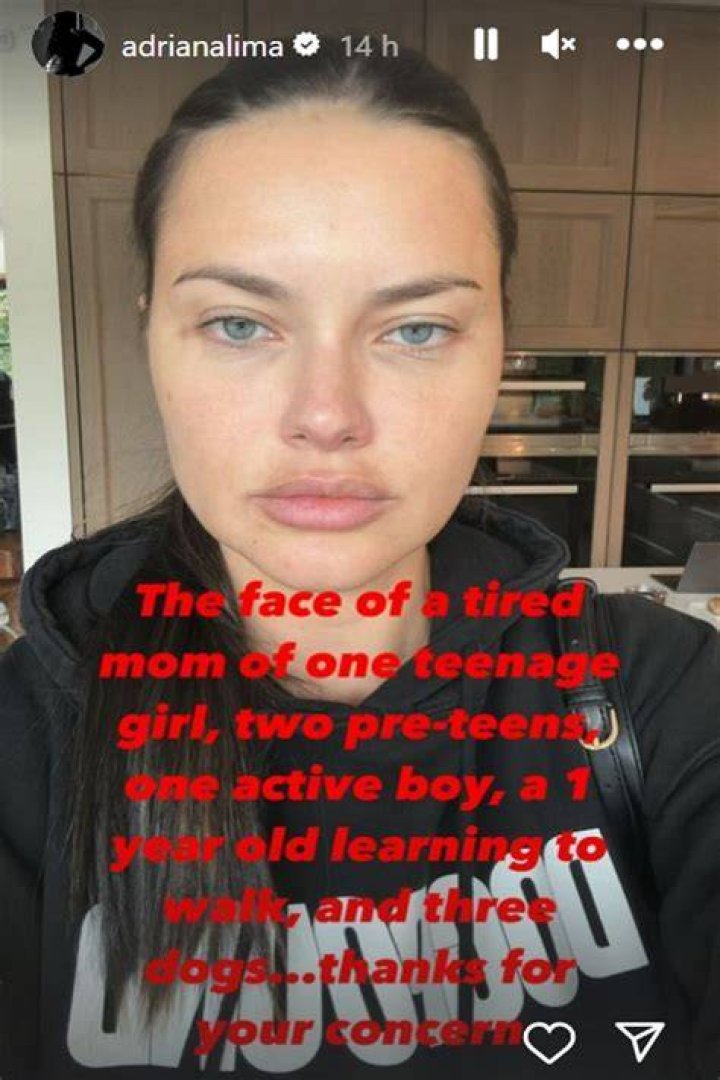 Adriana Lima, irreconocible en su &uacute;ltima aparici&oacute;n, responde a las