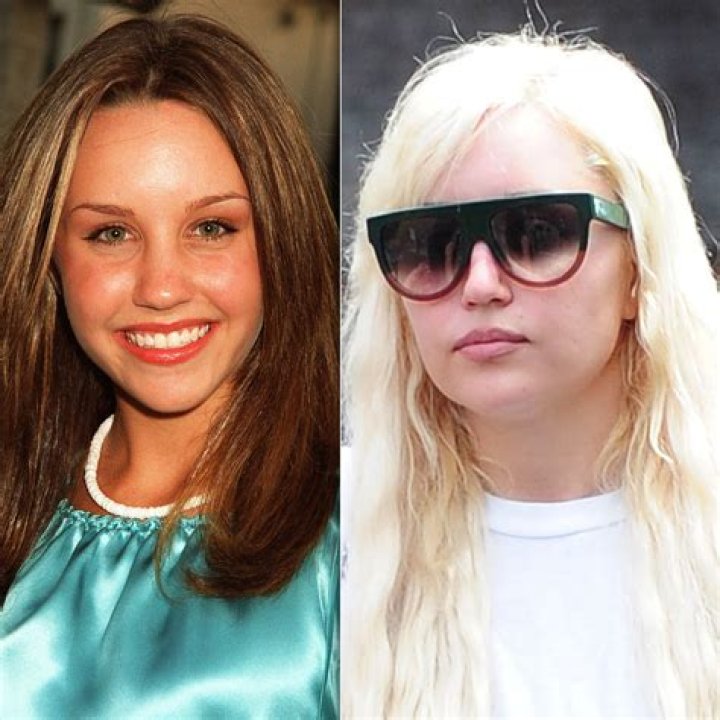 Amanda Bynes Transformation From Nickelodeon Star to Now