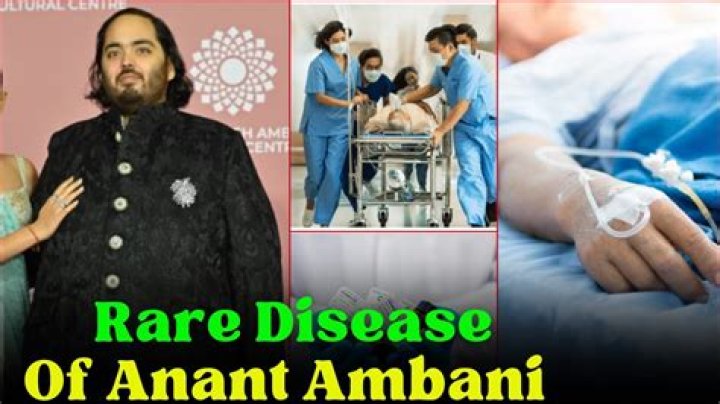 Anant Ambani Disease & Health Update Vor und nach der Gewichtsabnahme