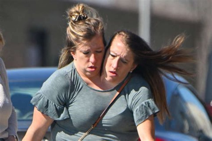 Are Abby and Brittany Hensel Still Alive? What Happened to Them?