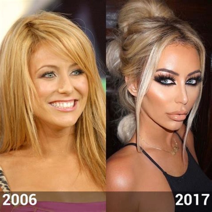 Aubrey O Day Before And After Pictures Full Transformation Journey