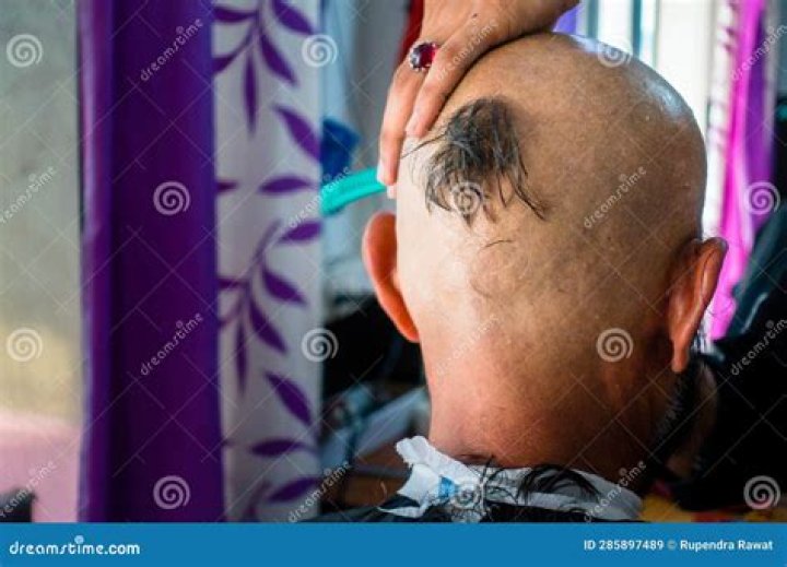 Bald guy corona ponytail r/malehairadvice