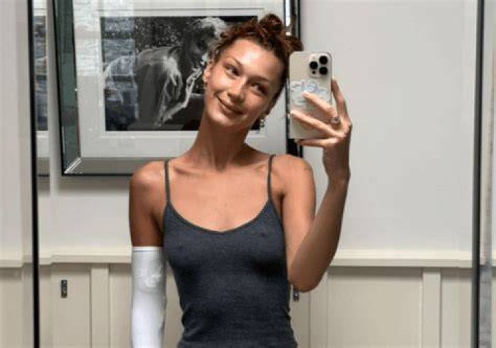 Bella Hadid shares update on Lyme disease diagnosis after suffering