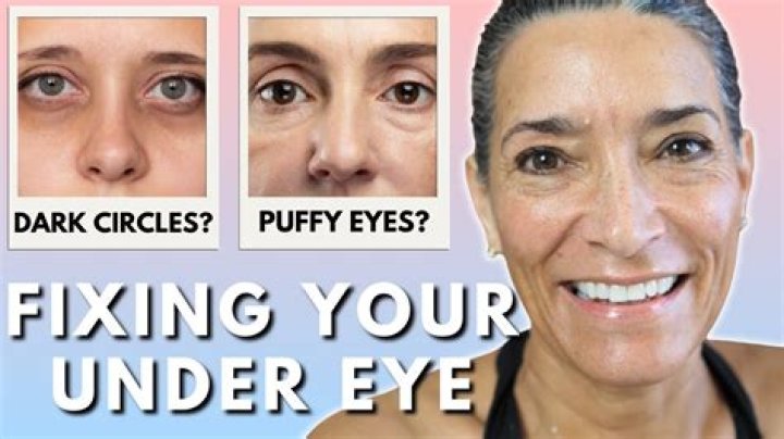 Best Eye Puffy And Dark Circle Products Beauty & Health