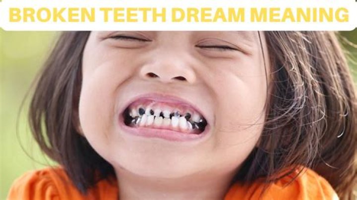 Broken Teeth Dream Meaning Indicate Confusion Or Insecurity