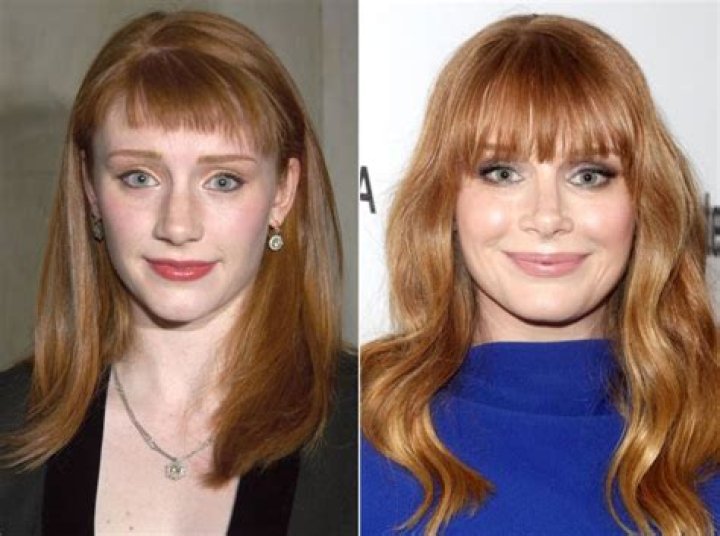 Bryce Dallas Howard Plastic surgery treatments and results