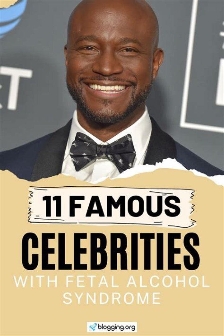 Celebrities Born with Fetal Alcohol Syndrome (2022)