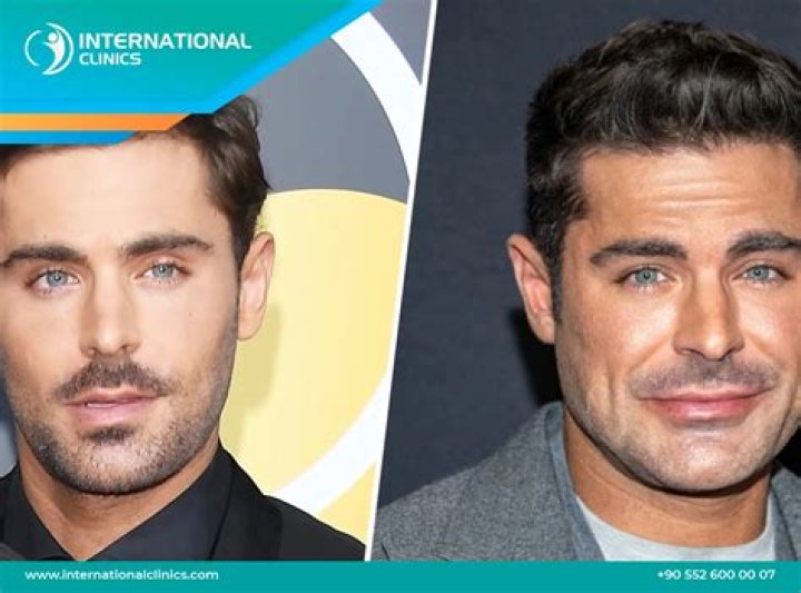 Celebrities with scars Chron
