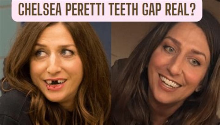 Chelsea Peretti Teeth Solo Para Adultos En Uruguay