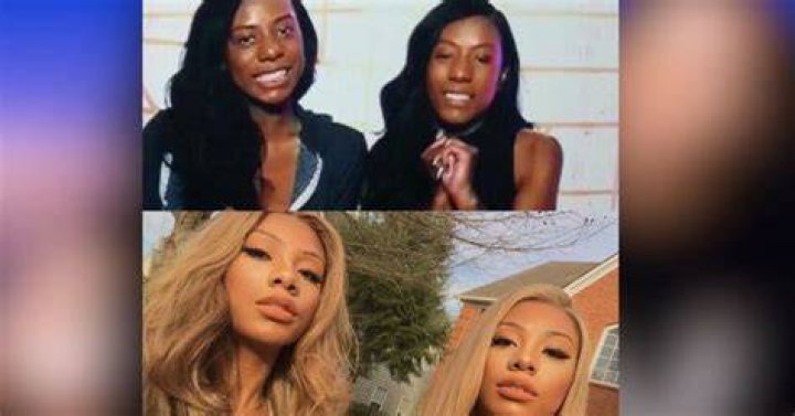 Clermont twins before and after The Clermont twins' lives before and
