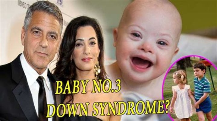 Clooney Son Has Down Syndrome A Look Into Their Inspiring Journey