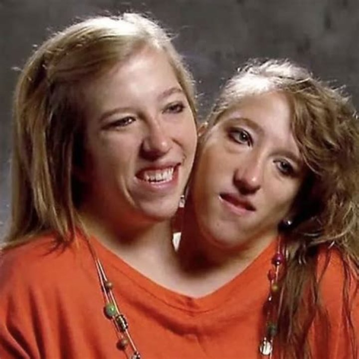 Conjoined twins abby and brittany hockeypole