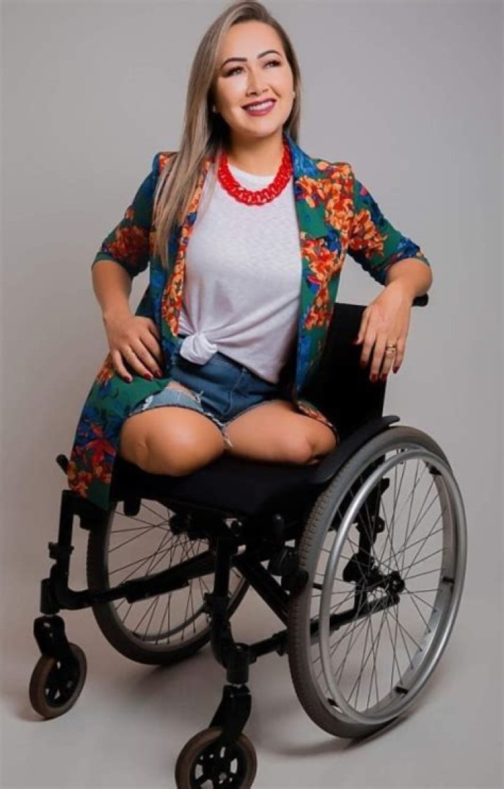 Dak Amputee Woman Bilateral Stumps