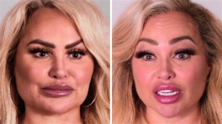 Darcey Gets MORE Plastic Surgery After Break Up Darcey & Stacey S2 E5