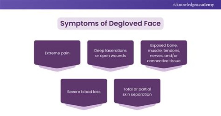 Degloved Face Image Gallery (Sorted by Oldest) (List View) Know Your Meme