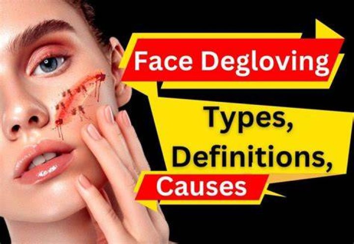 Degloved Face Understanding the Causes, Impacts and Recovery
