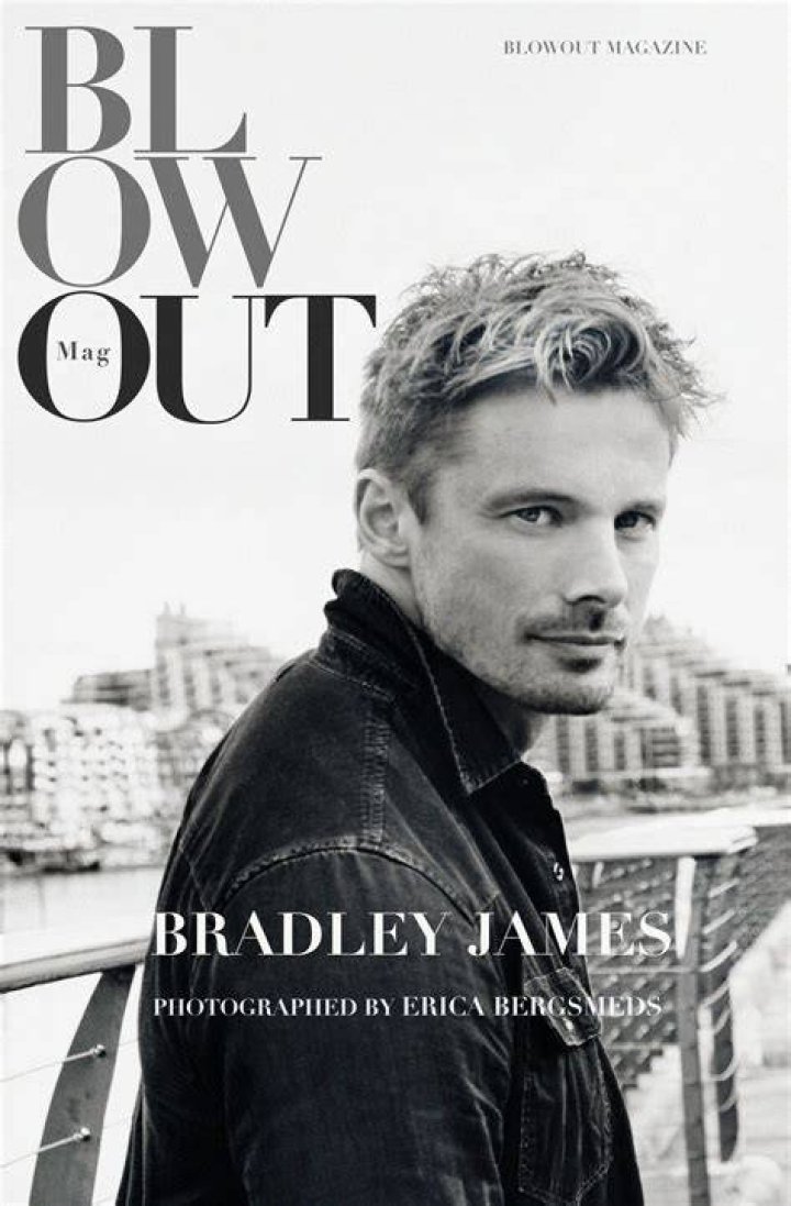 Did Bradley James Fix his Teeth? Why that's bad HubPages