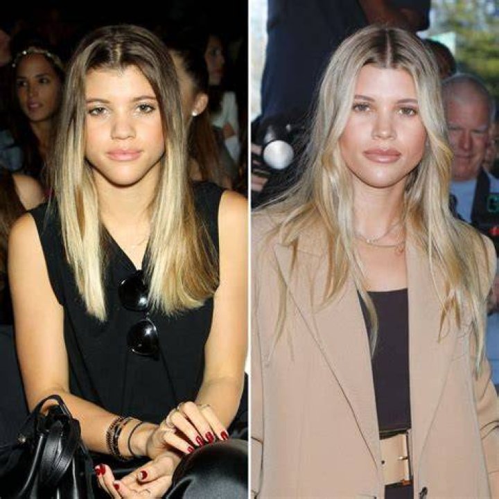 Did Sofia Richie Get a Nose Job? See Her Transformation Photos Amid