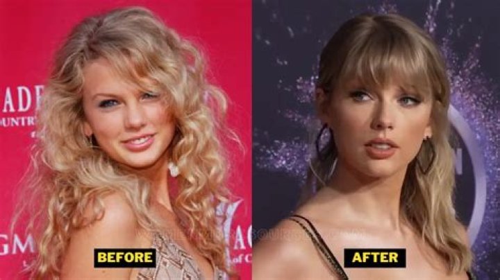 Did Taylor Swift Get Breast Implants?