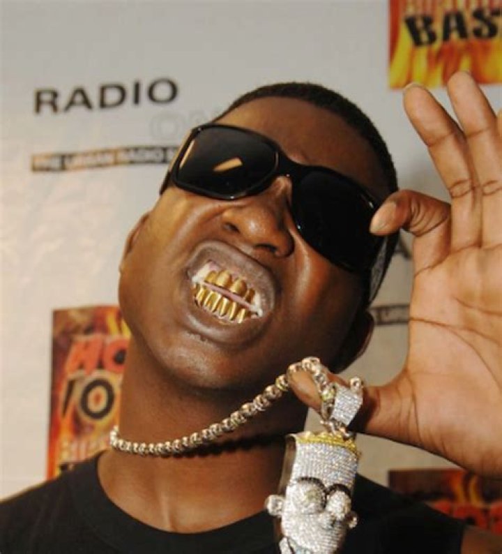 Does Gucci Mane Have Fake Teeth?
