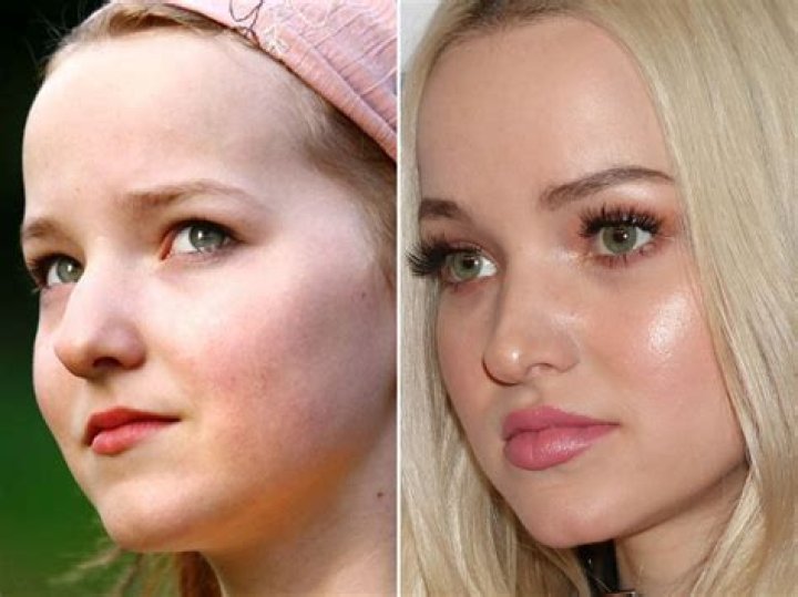 Dove Cameron, Before and After Dove cameron, Blonde actresses, New
