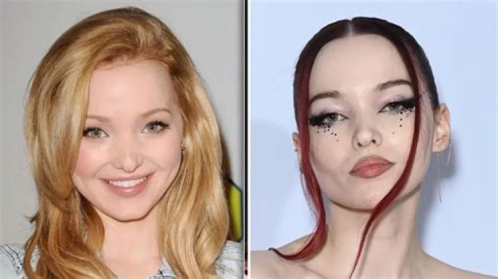 Dove Cameron Has Grown Up in the Public Eye &mdash; But Did She Get Plastic