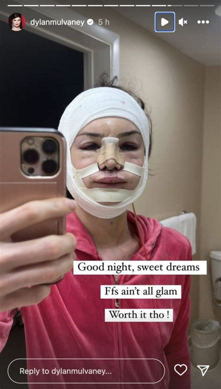 Dylan Mulvaney face reveal Her face before and after.