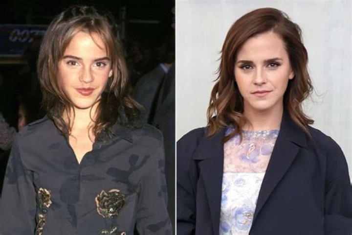 Emma Watson&rsquo;s Parents' Divorce Profoundly Changed Her Life As She