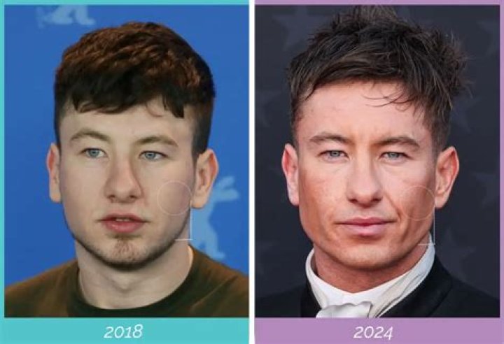 Exploring Barry Keoghan&rsquo;s Past Relationships Every Former Girlfriend