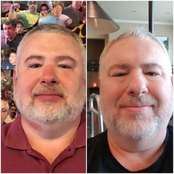 Face gain?? I'm done 21 lbs. Does it show? r/intermittentfasting