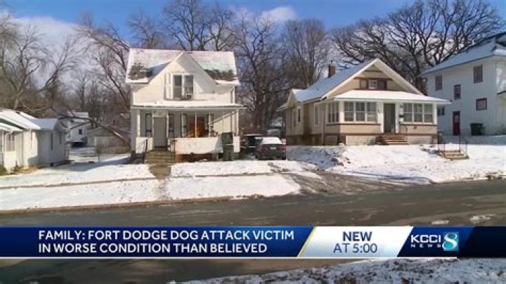 Fort Dodge dog attack victim has legs amputated, will need facial