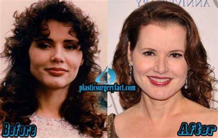 Geena Davis Before And After Plastic Surgery