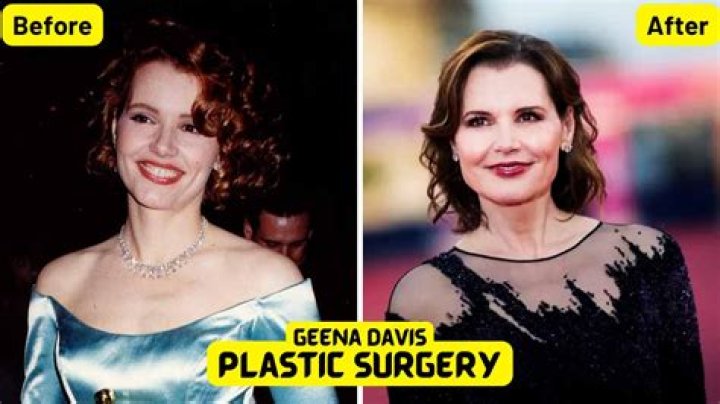 Geena Davis Plastic Surgery Rumors Plastic SurgerYes