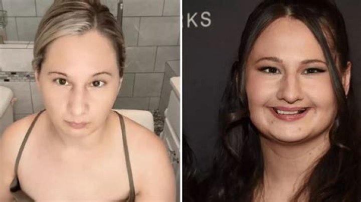 Gypsy Rose Blanchard Reveals How Her Nose Job Impacted Her Ego WDC NEWS 6