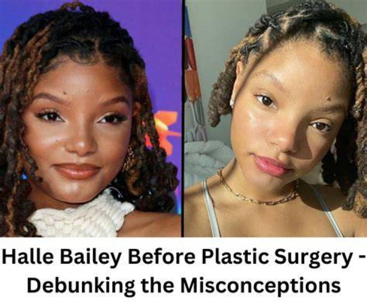 Halle Bailey Before Plastic Surgery Body Measurements, Nose Job