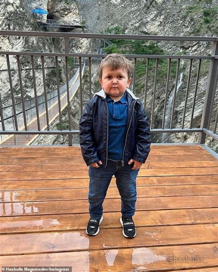 Hasbulla, who is he? Height, Age, Net Worth, and Condition Explanations