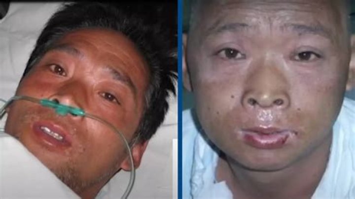 Hisashi Ouchi Autopsy Unveils Devastating Findings