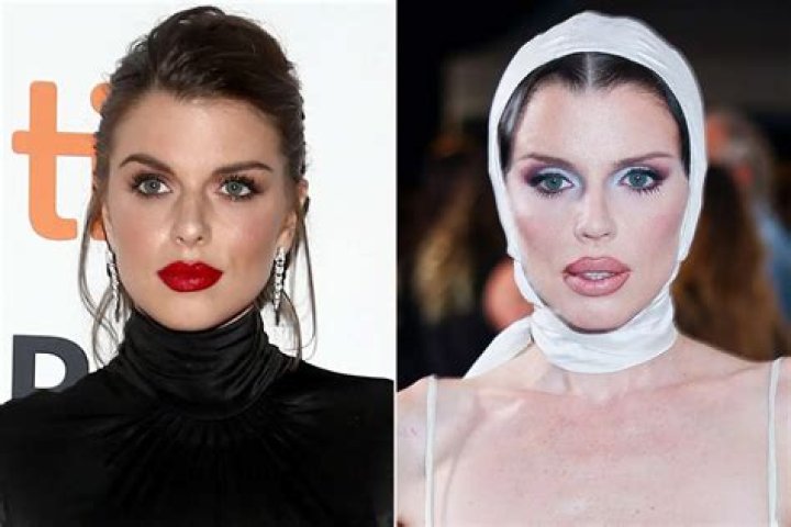 How Bobbie Spencer's Plastic Surgery Transformed Her Look