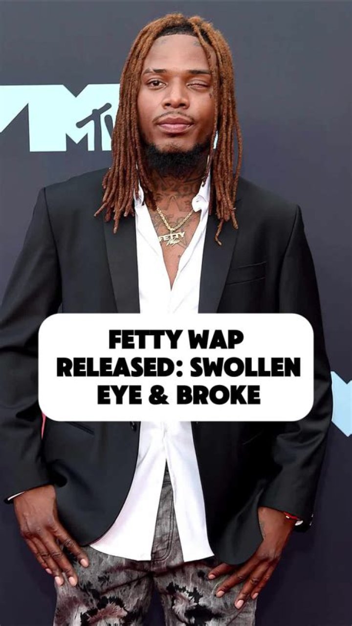 How Did Fetty Wap Lose His Eye?