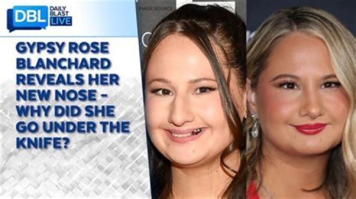 How many surgeries did Gypsy Rose have? Celebrity.fm 1 Official