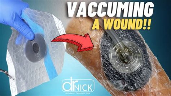 How to get a vac ban remover flogasw
