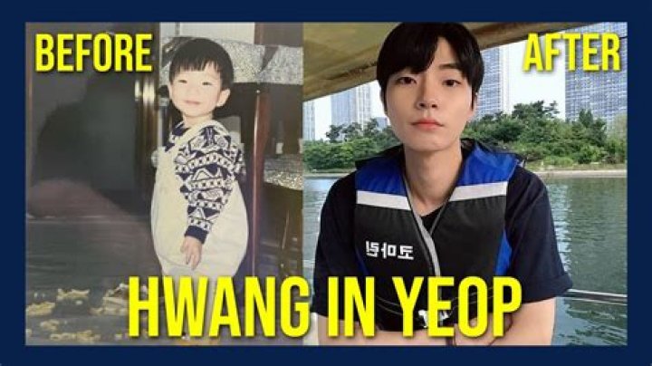 Hwang In Yeop Before And After Plastic Surgery Asian Celebrity Profile