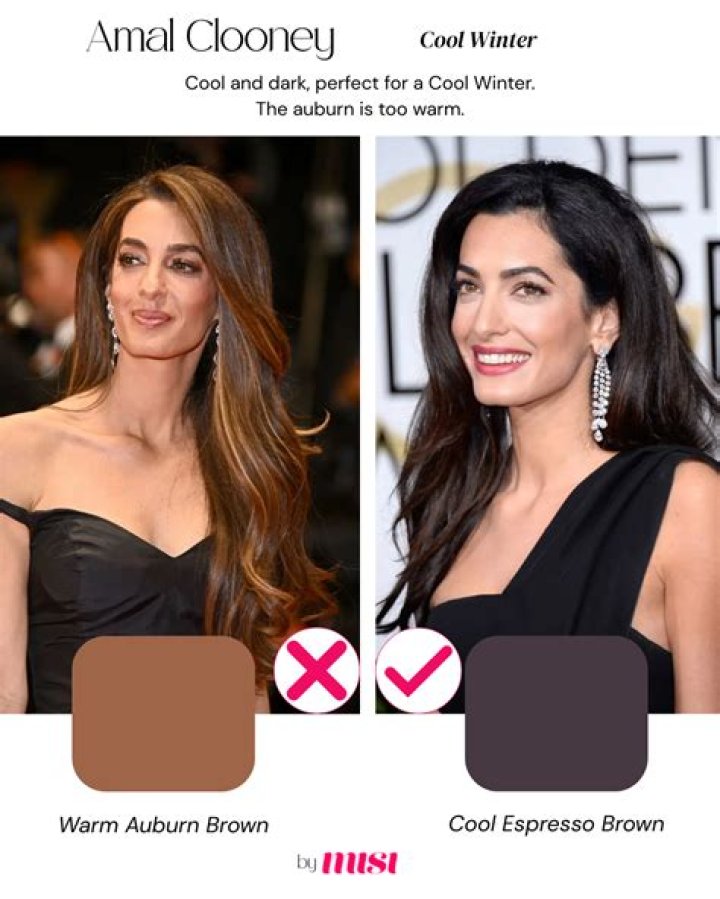 Insightful Analysis Clooney's Twins And Down Syndrome