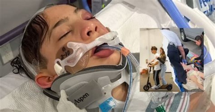 Is Nidal Wonder Dead? What Happened To Nidal Wonder? (Scooter Accident